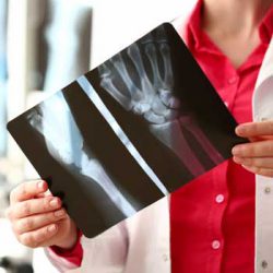 Female radiologist hold in hand xray film Female radiologist hold in hand x-ray film image aganist hospital office background. CT scan of bone health concept.
